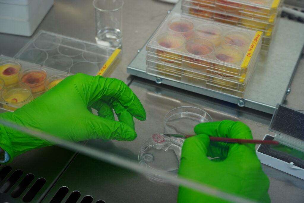 Výskumná skupina Molekulárna onkológia