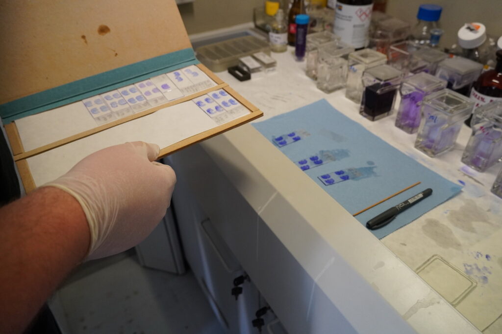 Výskumný tím Ischémia mozgu