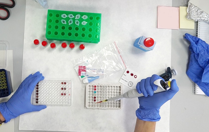 Práca v laboratóriu v rámci séroepidemio...