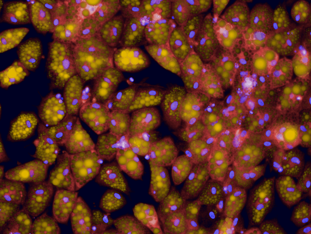 Staining of fat droplets (yellow), nucle...