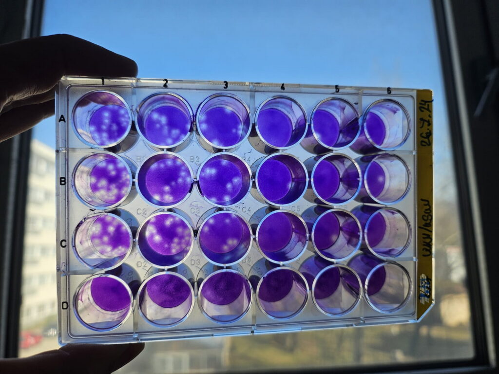 Výskumná skupina Ekológia vírusov