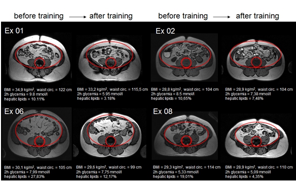 Účinok trojmesačného silového tréningu
