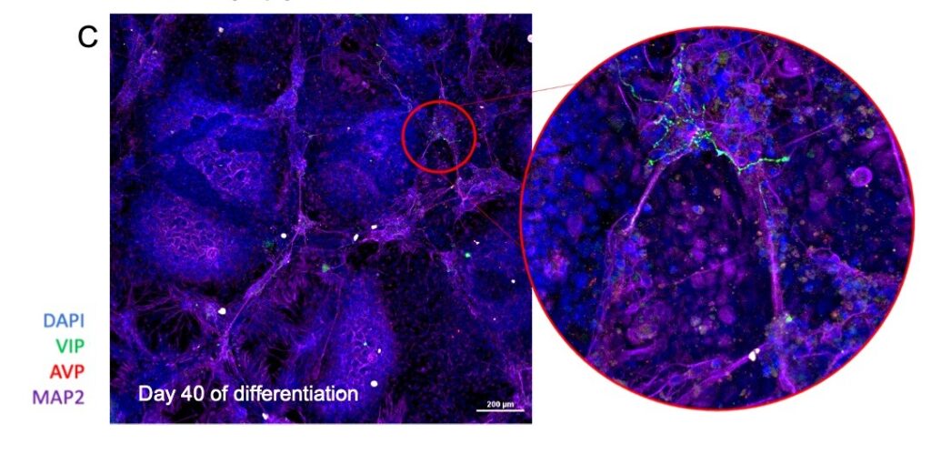 Ilustračný obrázok týkajúci sa výskumu p...