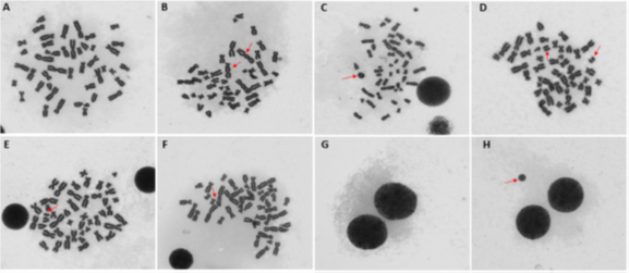 Metaphase chromosomes on which we observ...